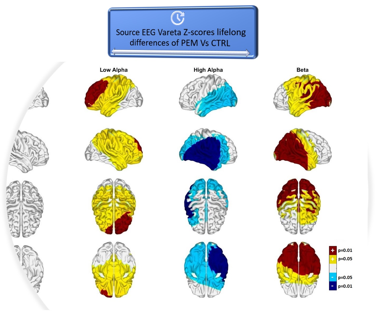 Global EEG Norms Image